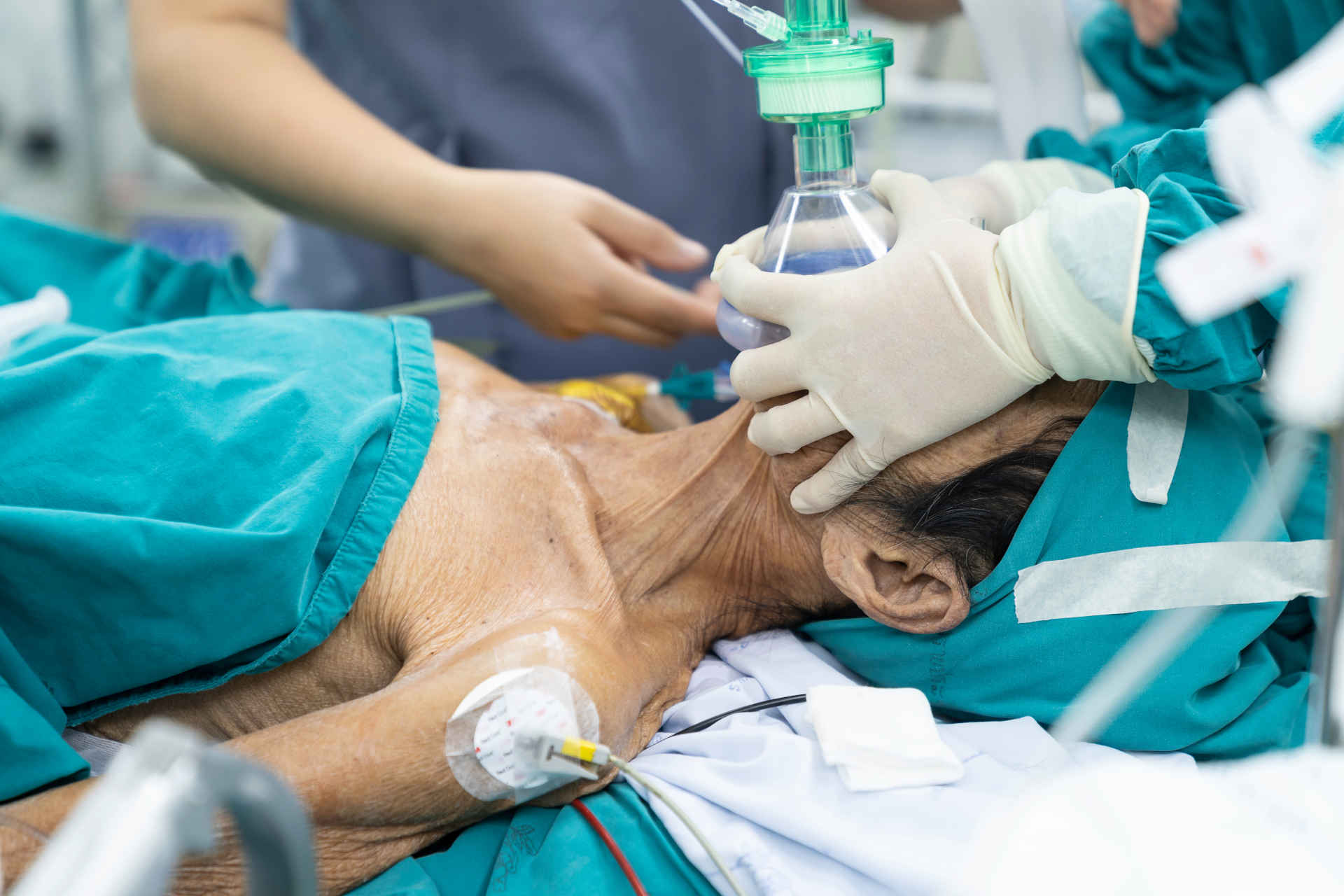 Patient being pre-oxygenated