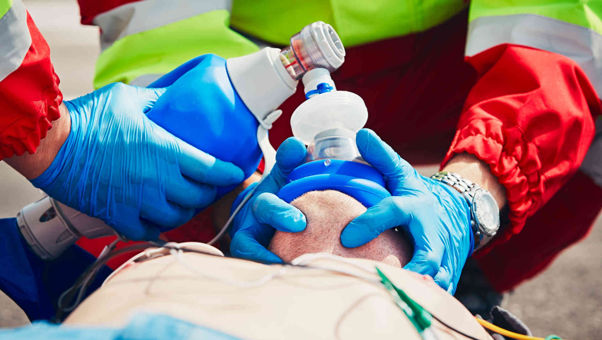 Patient receiving manual bag-mask ventilation