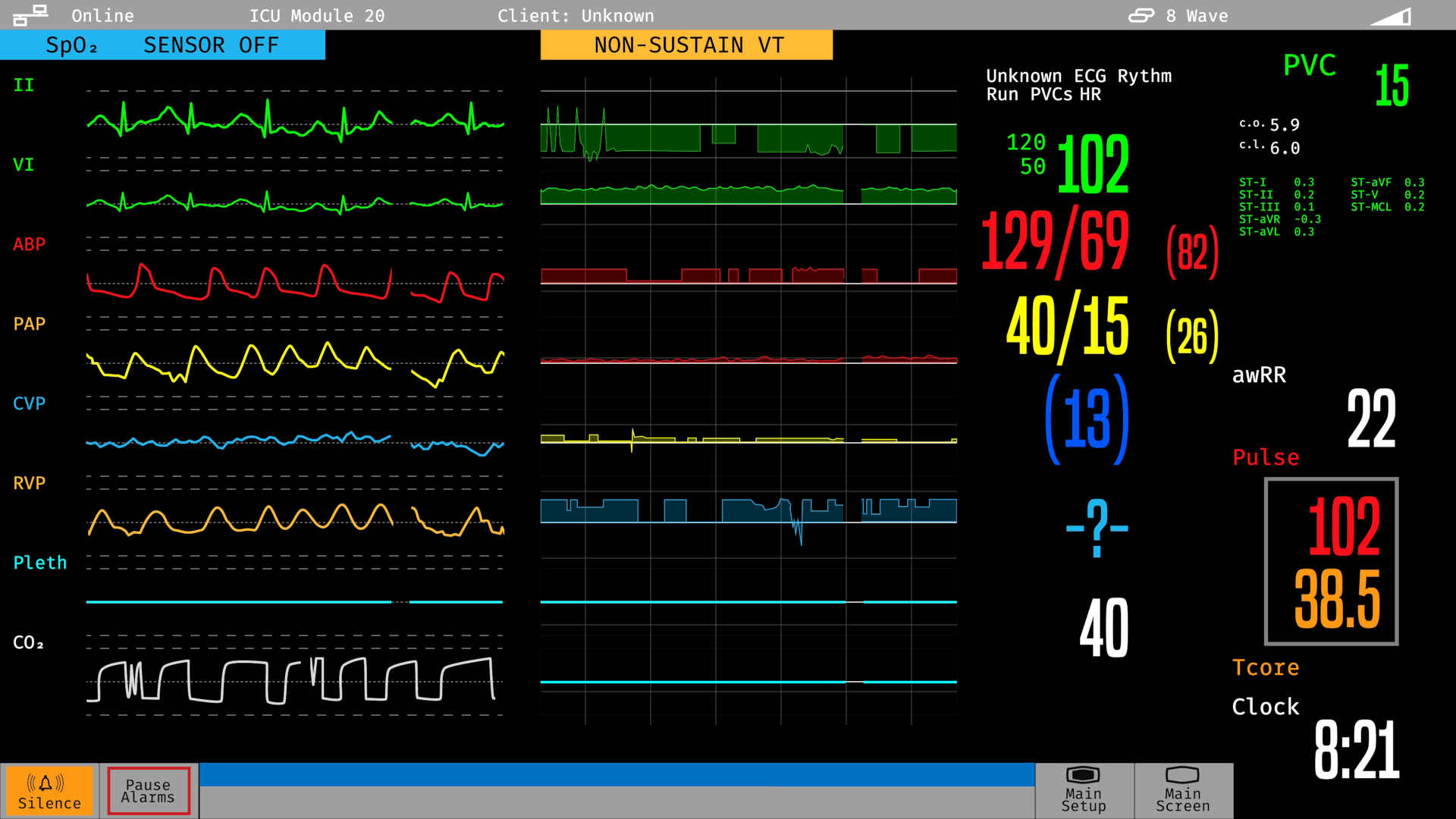 Bedside monitor showing vital signs