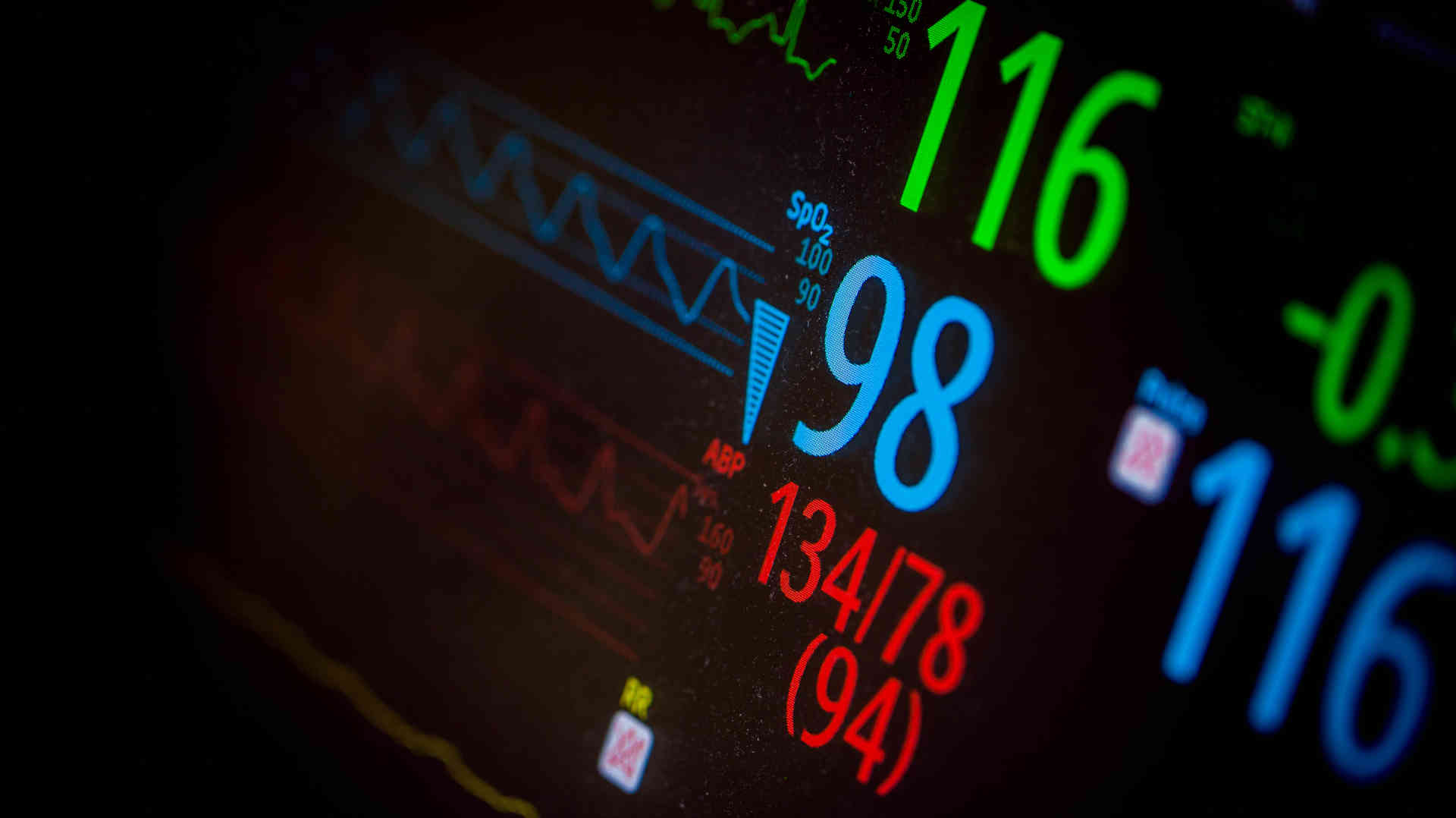 Bedside vital signs monitor