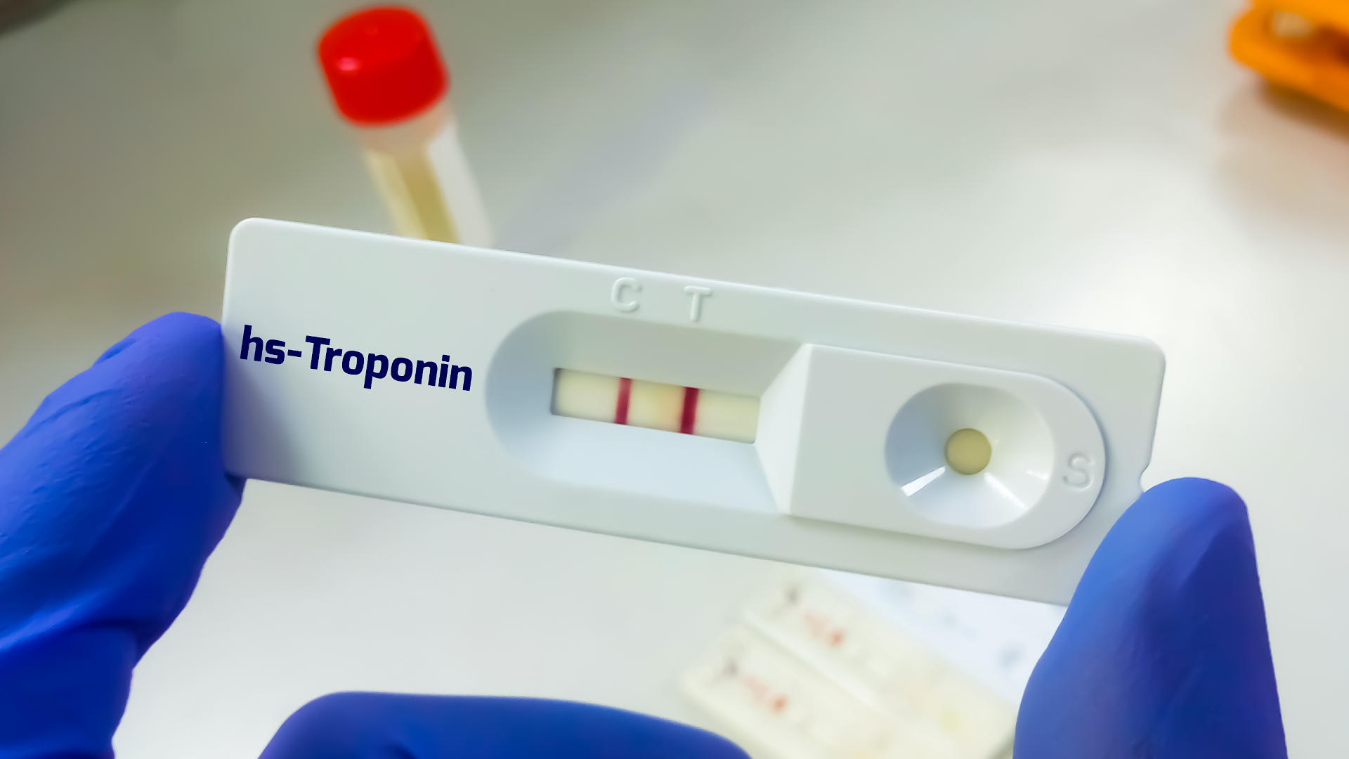 Bedside hs-Troponin assay