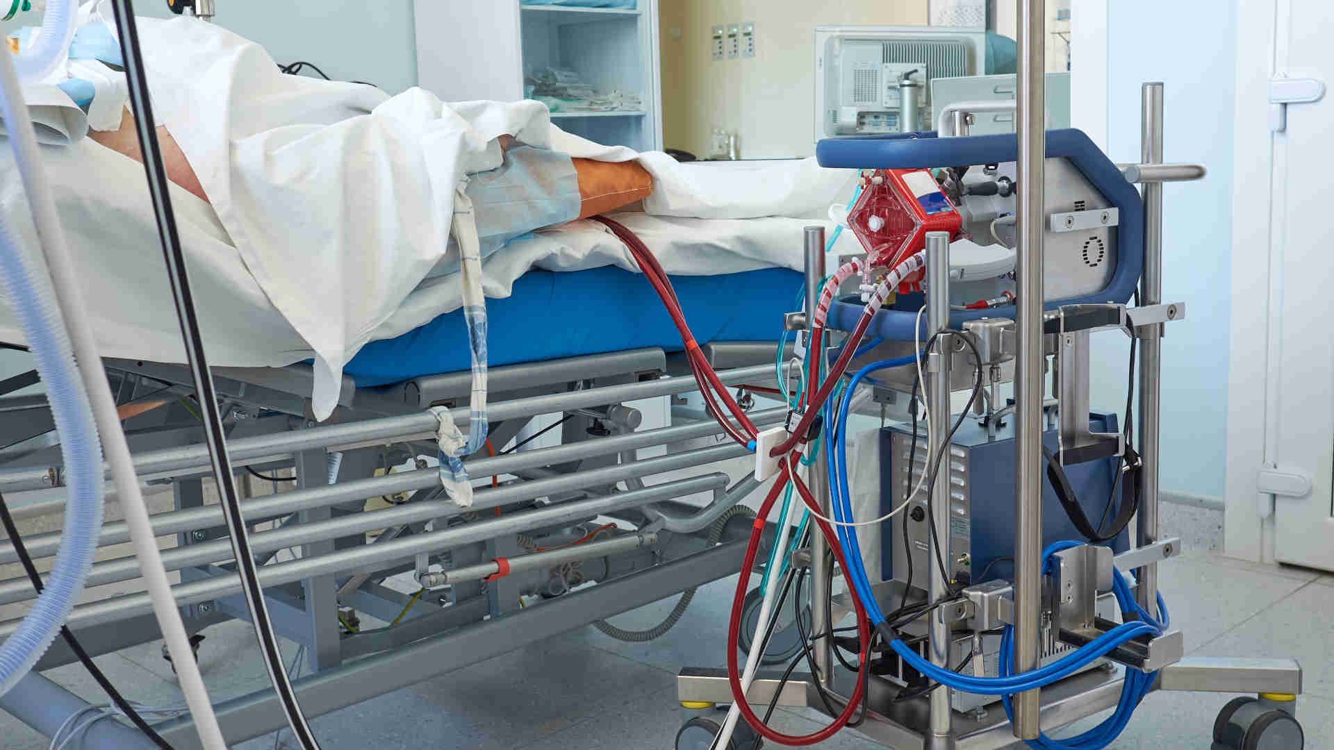 Patient attached to an ECMO machine
