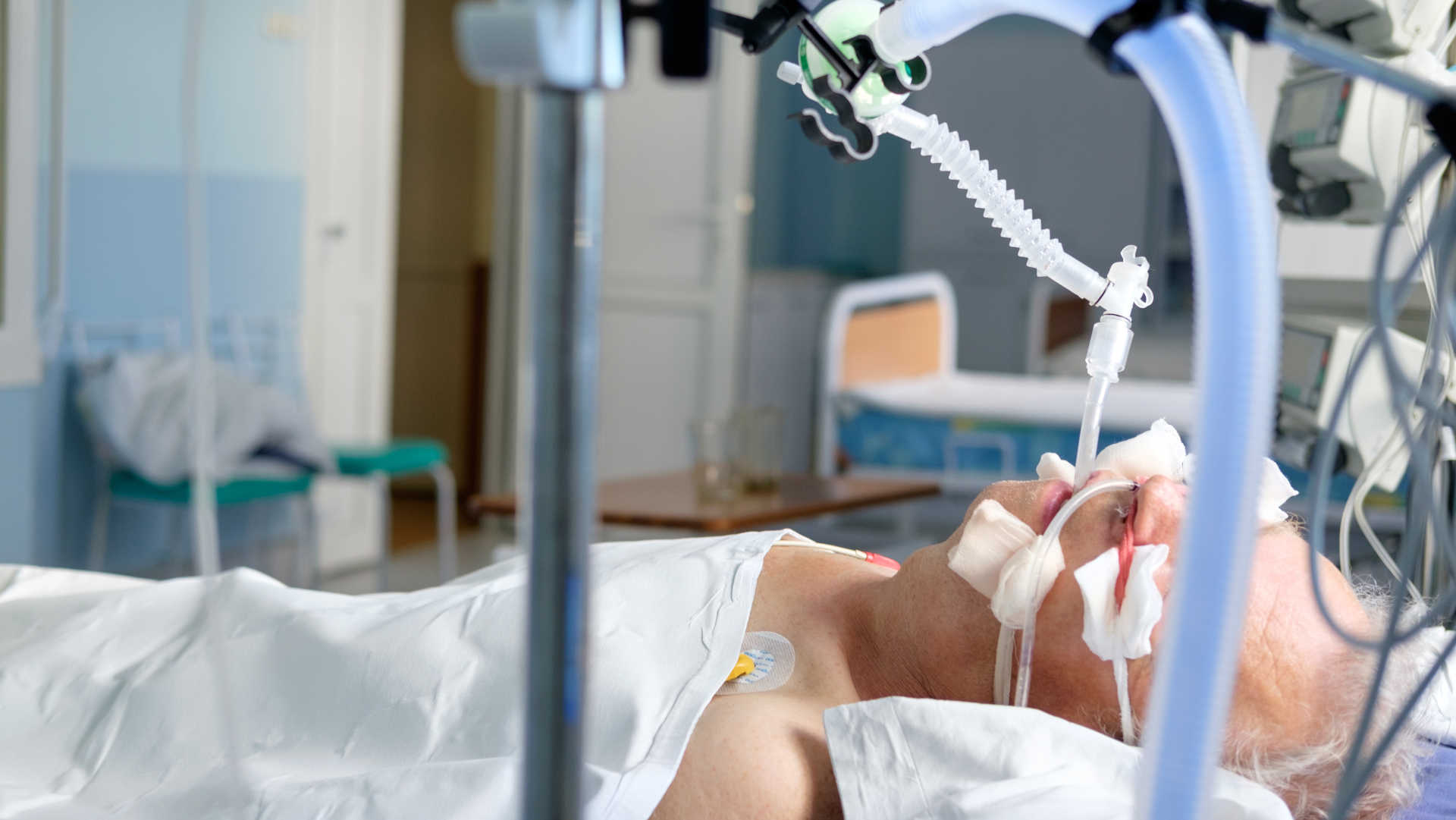 Invasively ventilated patient in the ICU