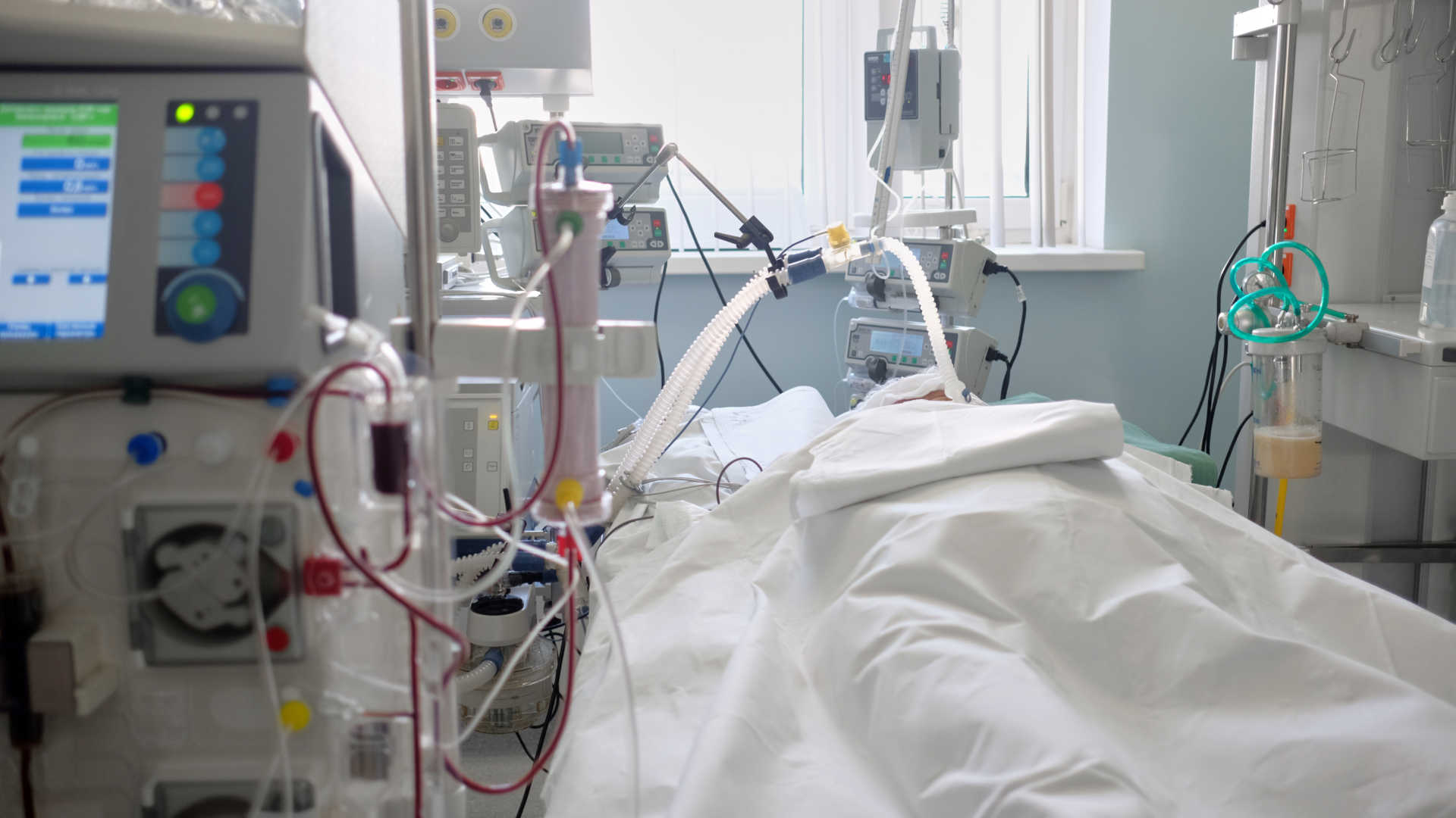 Patient in the ICU