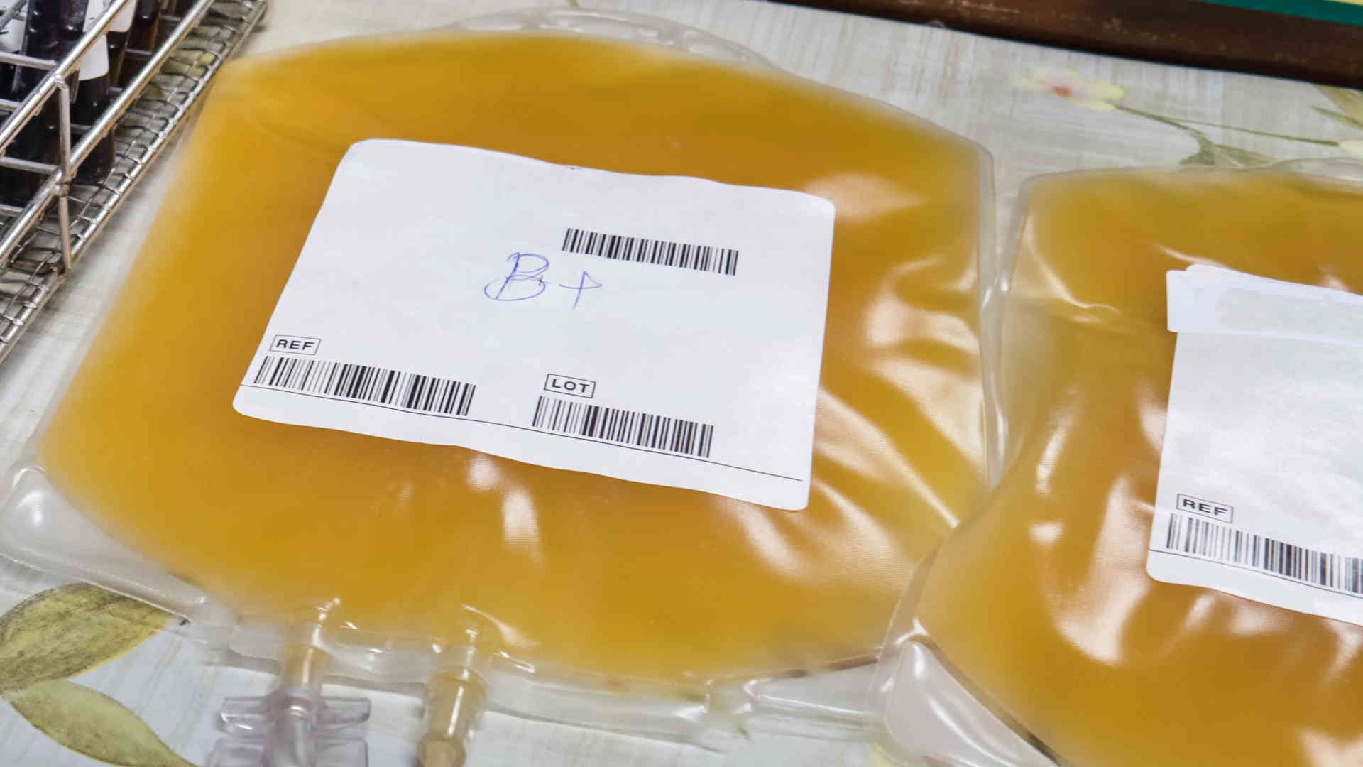 Two bags of platelets