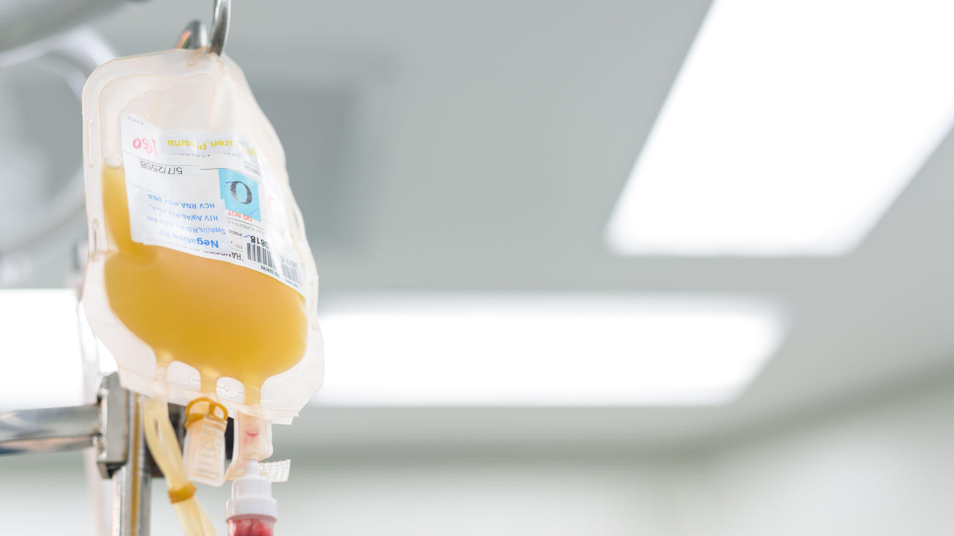 Bag of platelets hanging on a drip stand