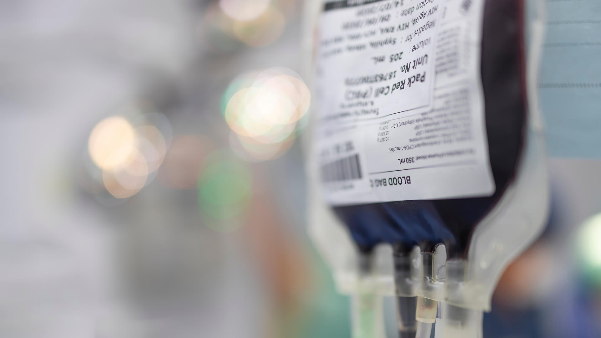 A bag of red blood cells hanging for transfusion