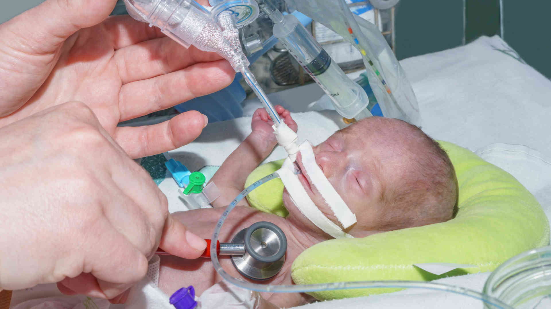 Bronchoscopy in the ICU