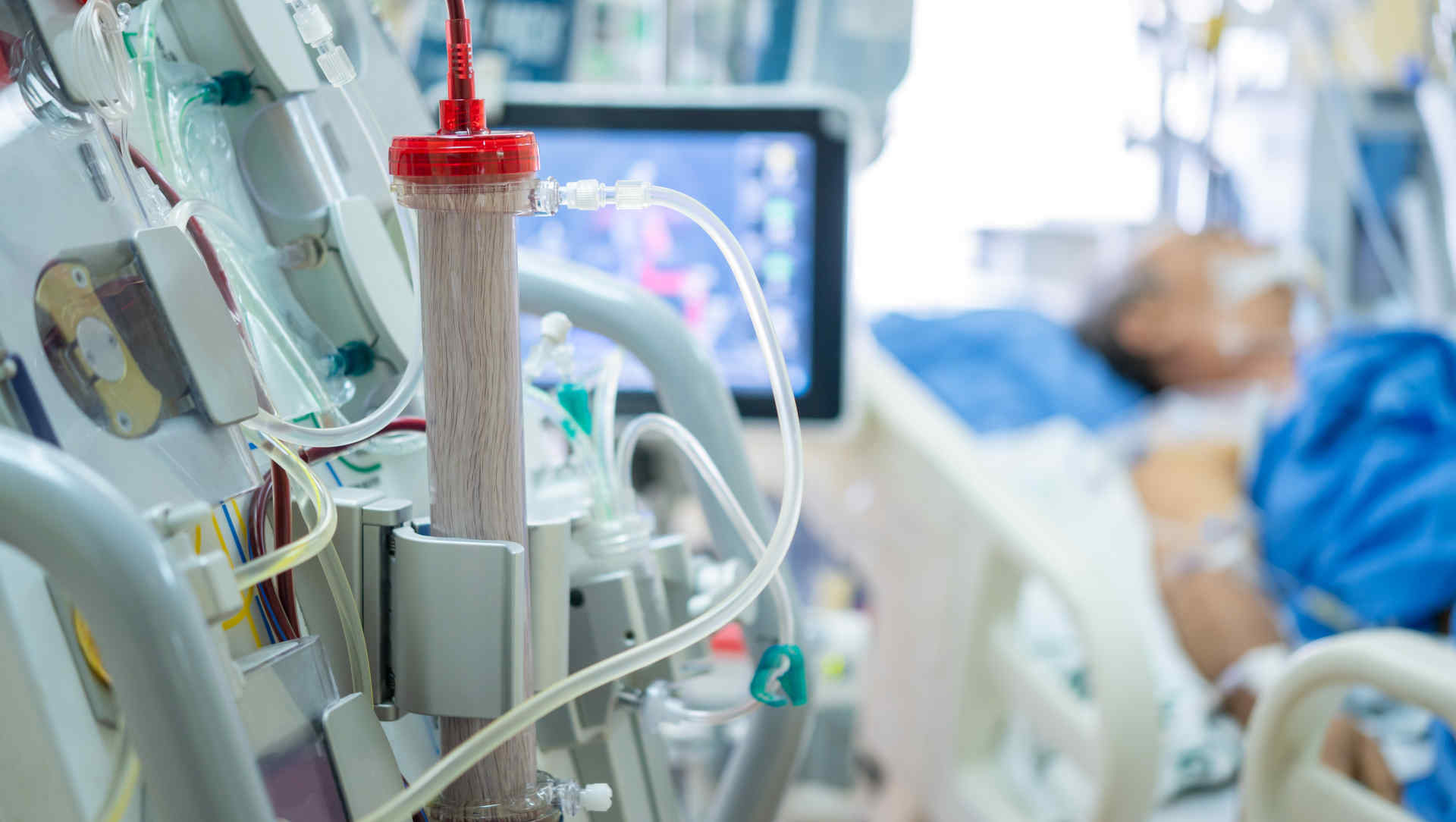 Ventilated ICU patient with a tracheostomy tube