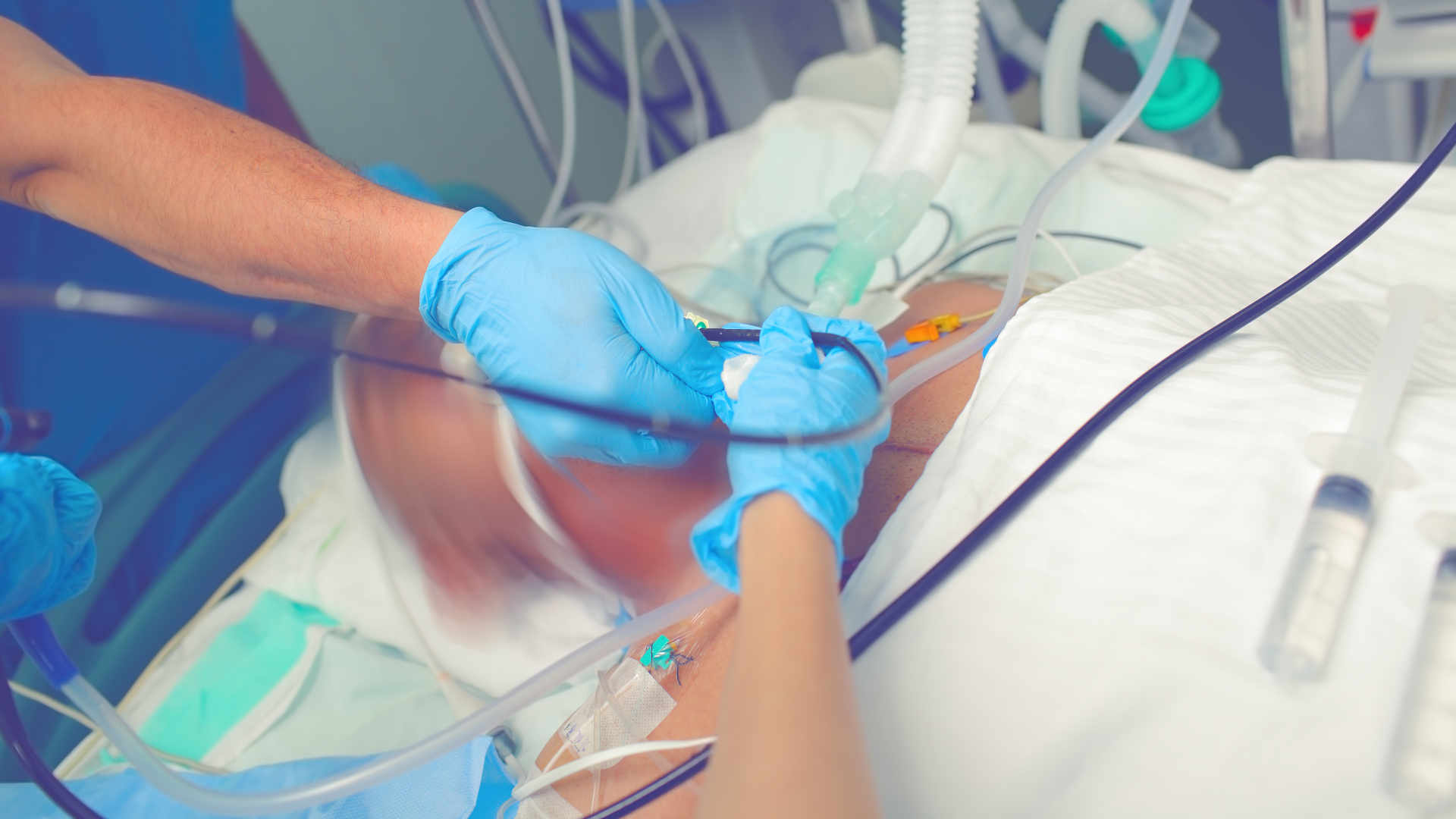 Bronchoscopy in the ICU