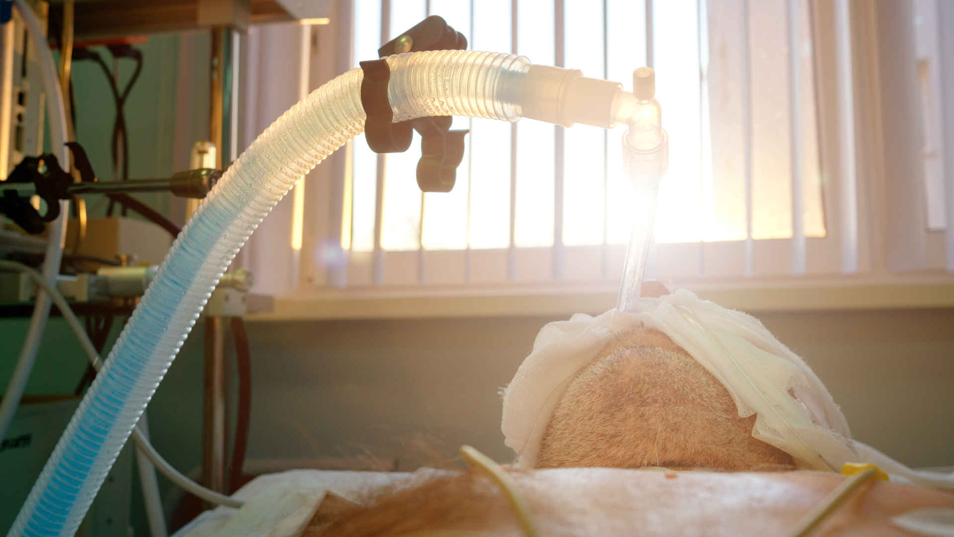 Intubated patient in the ICU