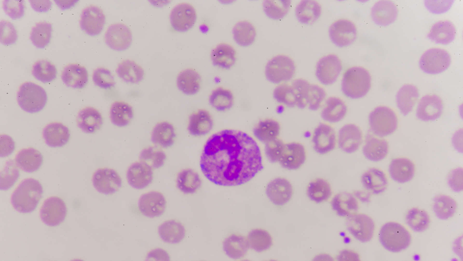 Blood film showing bacteraemia