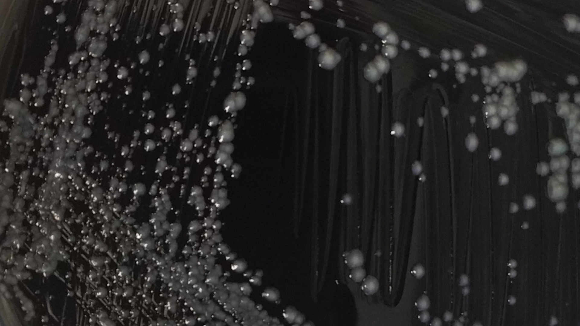 Agar plate showing Legionella Pneumophila