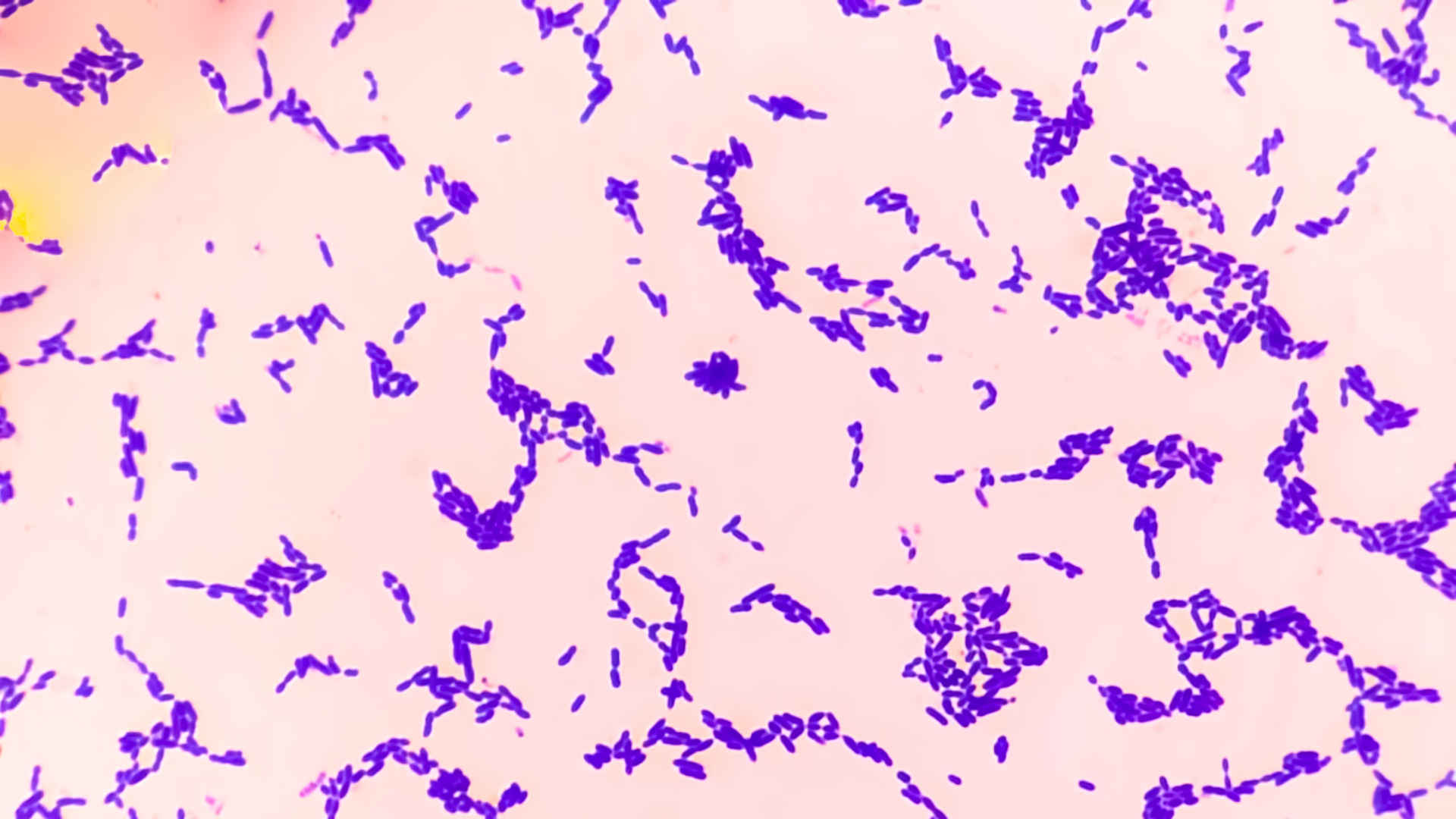 Klebsiella pneumoniae culture on an agar plate