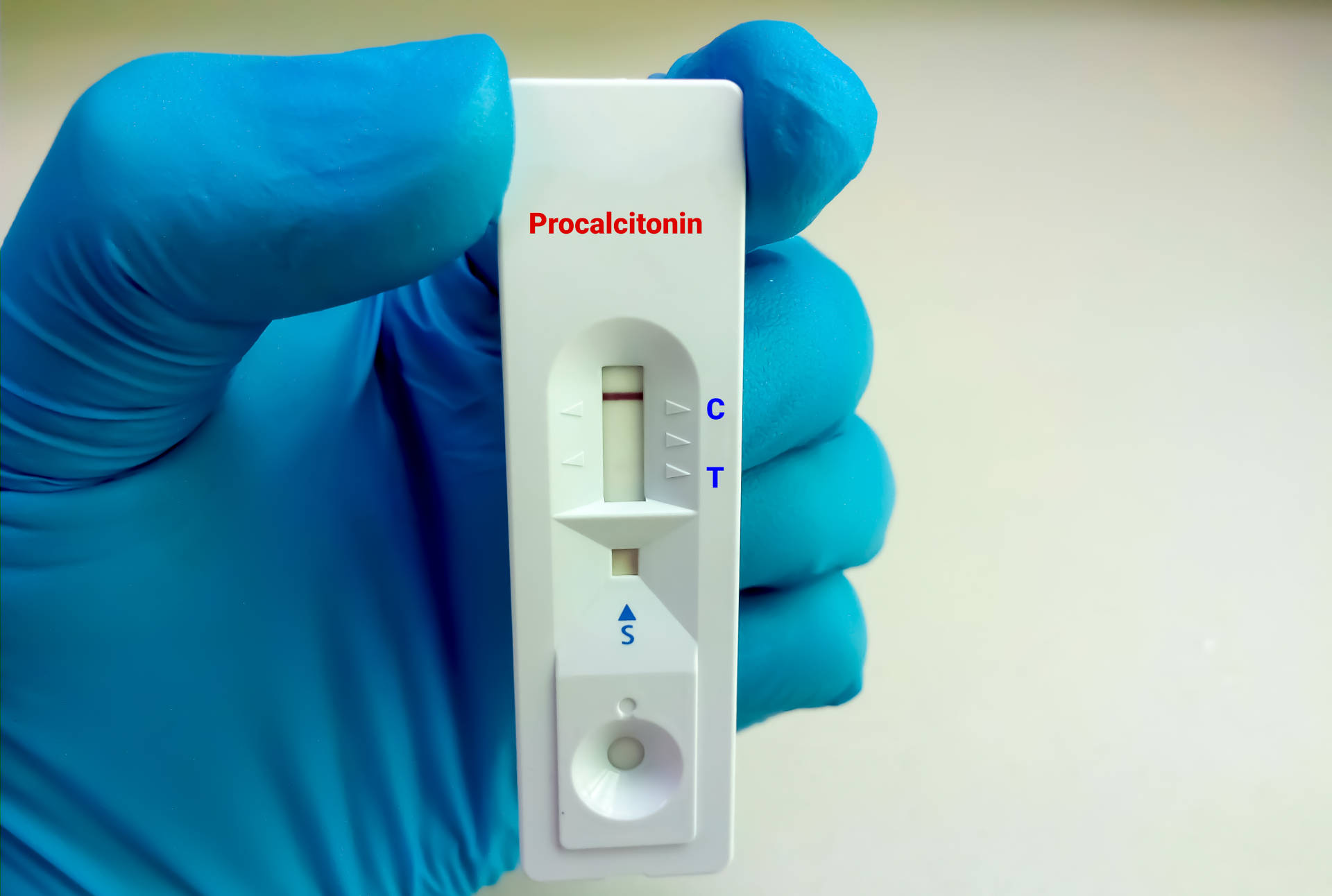 Procalcitonin point-of-care assay