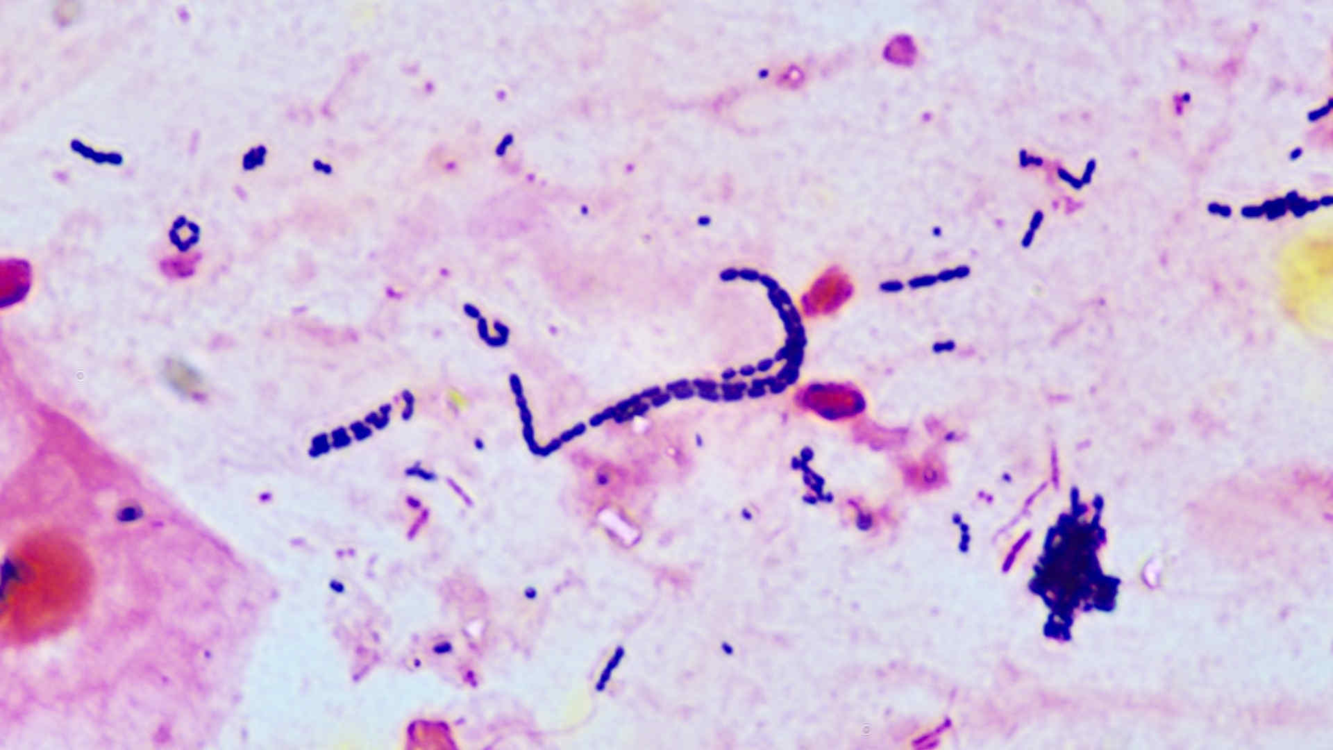 Streptococci in a blood film