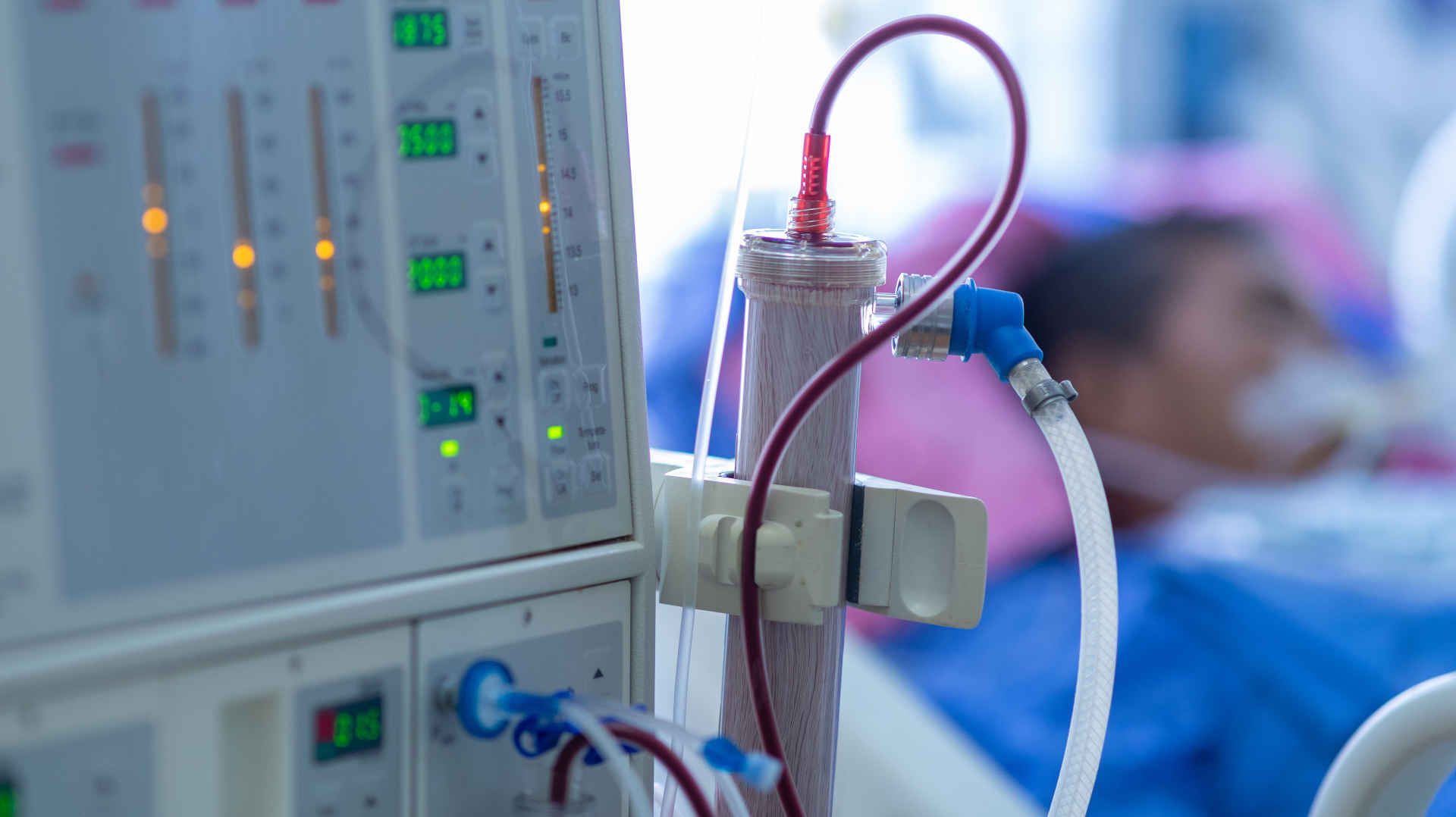 Dialysis machine beside an ICU patient