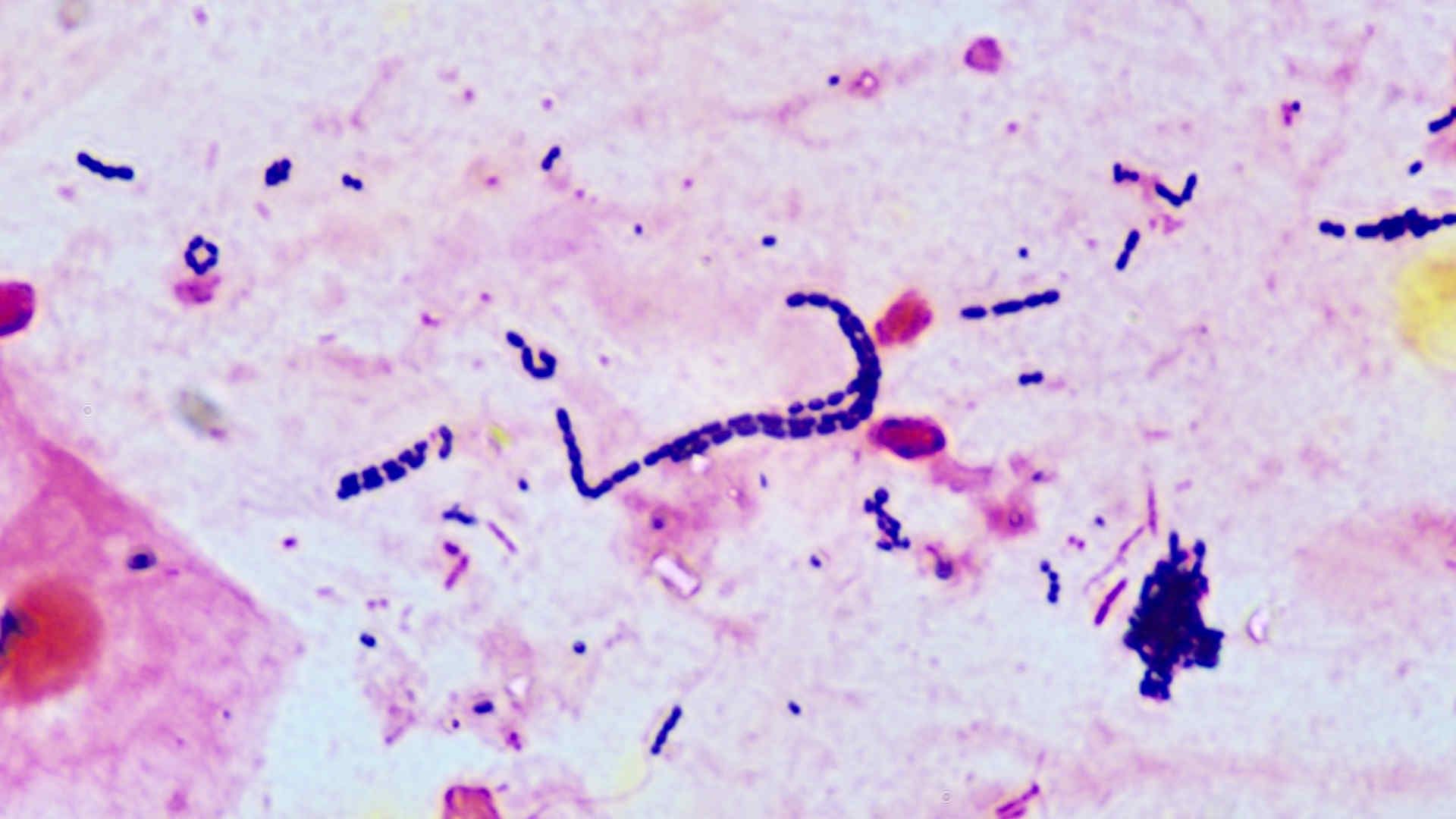 Streptococci in blood