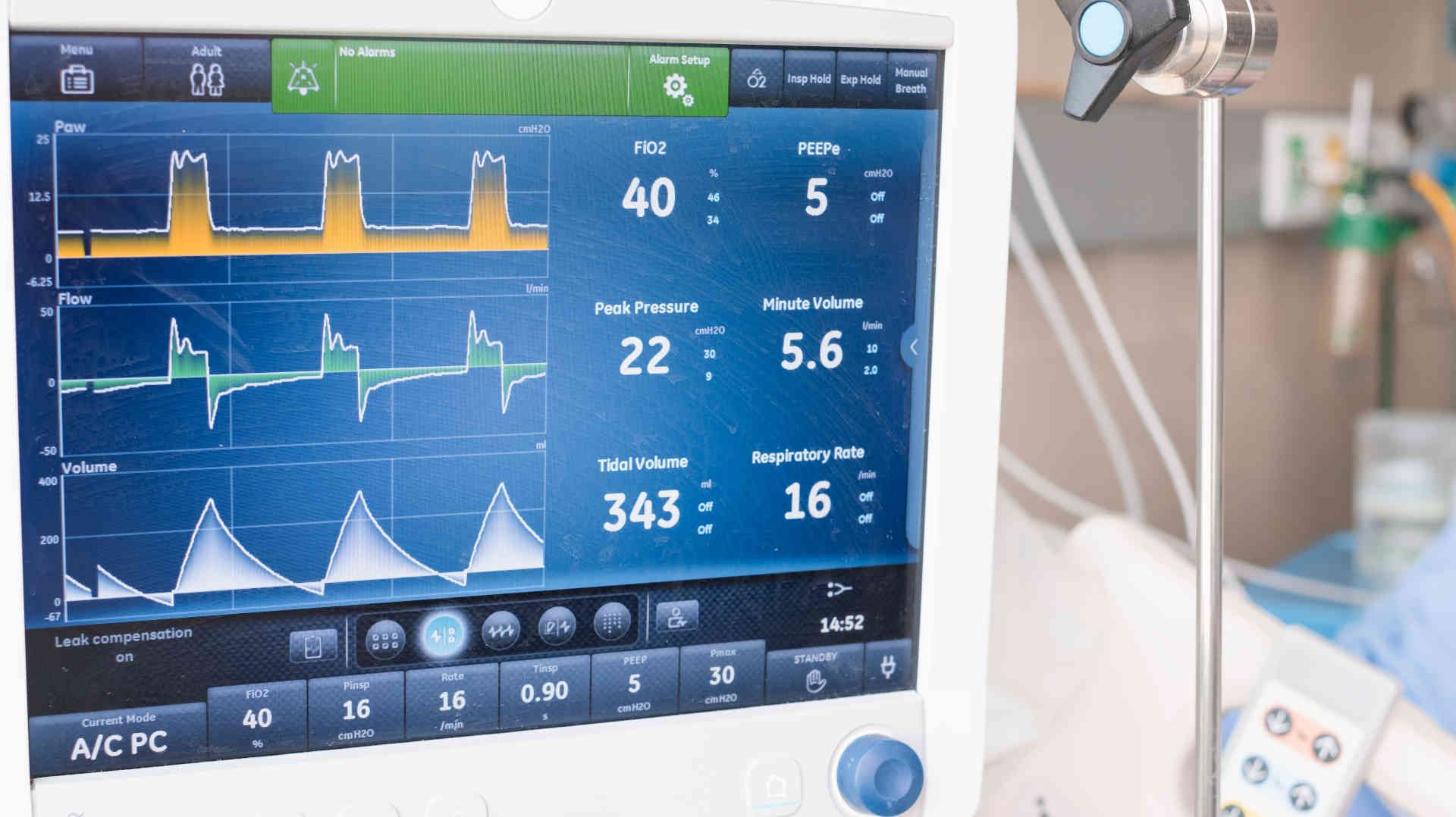 Screen of a mechanical ventilator