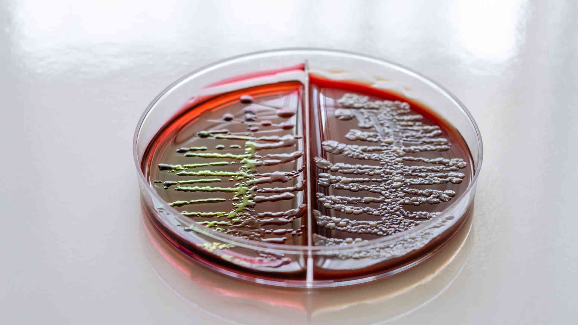 Klebsiella pneumonia in blood culture