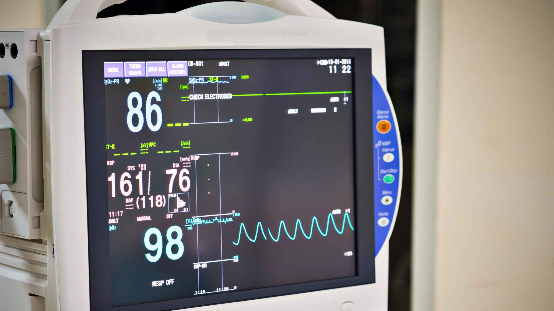 Vital monitor showing high blood pressure